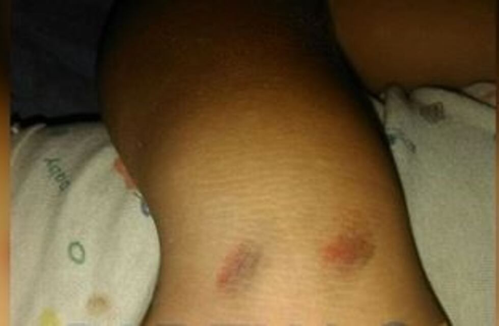 Desgarrador relato de la madre del niño picaneado en un robo: "Mi bebé le decía a la ladrona 'nene no'"