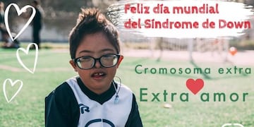 El Empate FC y su mensaje en el Día Mundial del Síndrome de Down\u002E