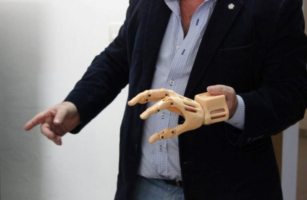 Presentaron las primeras prótesis 3D fabricadas en Río Gallegos