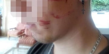Un joven fue brutalmente atacado por una patota en La Falda\u002E (Foto: gentileza ElDoce\u002Etv)\u002E
