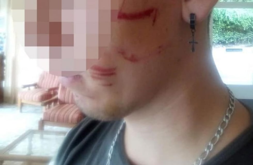 Un joven fue brutalmente atacado por una patota en La Falda