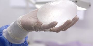 La ANMAT prohibió un implante mamario vinculado con un tipo raro de cáncer\u002E (REUTERS)
