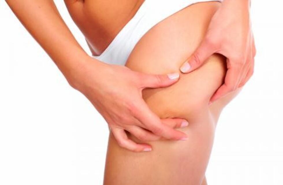 Hablemos de celulitis