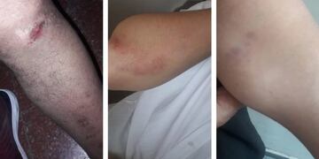 Violencia familiar\u002E