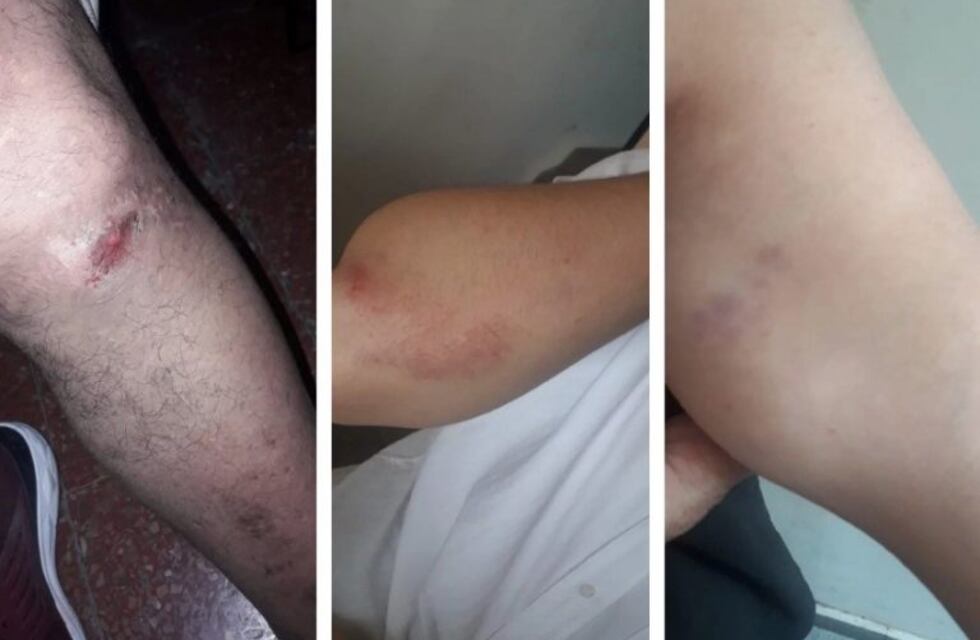 Descontrolado, atacó a golpes a sus hijos y a su ex cuñado