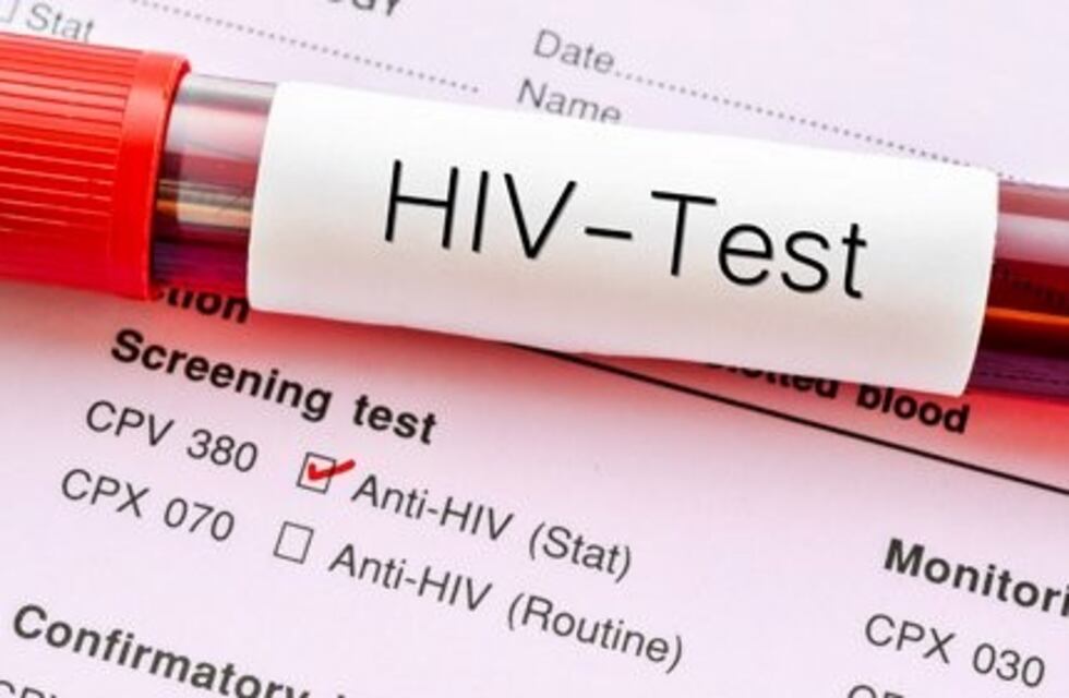 El 27 de junio habrá testeos de VIH gratuitos