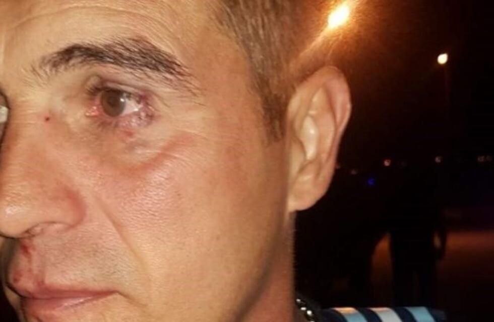 El DT de Peñarol apuntó contra un policía tras la brutal agresión en San Luis