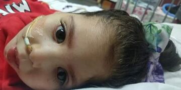 Organizan una peña solidaria para ayudar a una beba que padece una enfermedad en el cerebro