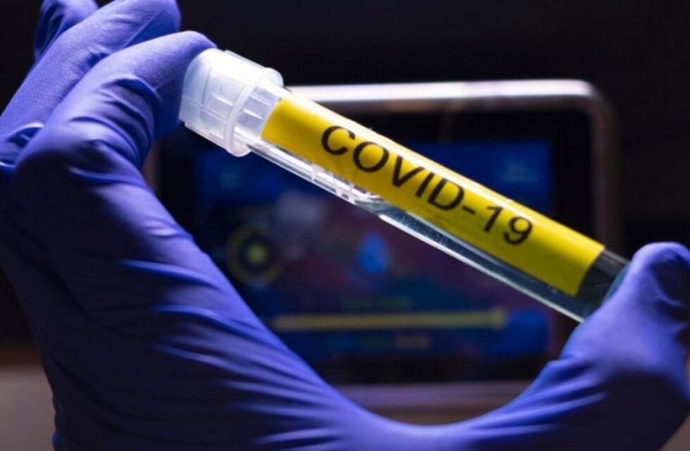 Se registraron 30 nuevos casos de coronavirus en Gualeguaychú