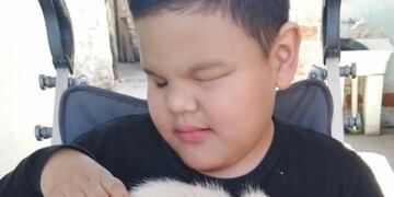 Thiago tiene parálisis cerebral y ceguera y necesita ayuda para caminar por primera vez.