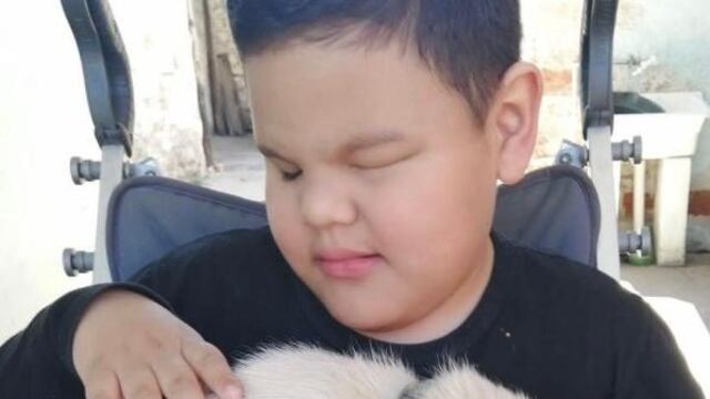 Thiago tiene parálisis cerebral y ceguera y necesita ayuda para caminar por primera vez.