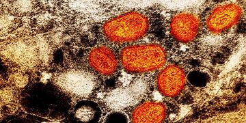 La enfermedad se detectó en Argentina a partir del 27 de mayo de 2022.