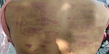 Niño vendedor de churros era castigado si no vendía todo