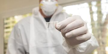 Detección de coronavirus en Mendoza. Foto: Gobierno de Mendoza.