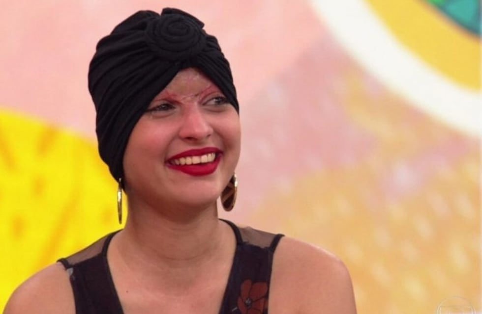 Un accidente en karting le cambió la vida para siempre y lo muestra en Instagram