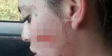 Denuncia por violencia de Género en Salta\u002E (Web)