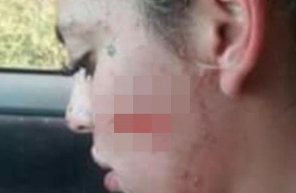Le cortó la cara y ahora amenaza con pegarle un tiro en las rodillas