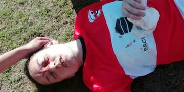 Jugadora de Universitario ensangretanda\u002E (Foto: InfoLiga)