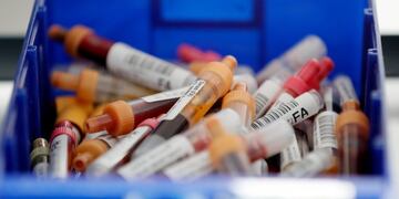 Ingelheim (Germany), 23/04/2020\u002E- An view of corona tests inside the Laboratory at Bioscientia Healthcare GmbH in Ingelheim, Germany, 23 April 2020\u002E The largest medical laboratory in Rhineland-Palatinate, Bioscientia Healthcare GmbH in Ingelheim, is one of the performance centres for corona diagnostics in Germany\u002E In the laboratory in Ingelheim, up to 3,500 PCR examinations for the coronavirus are carried out daily\u002E Countries around the world are taking increased measures to stem the widespread of the SARS-CoV-2 coronavirus which causes the Covid-19 disease\u002E (Alemania) EFE/EPA/RONALD WITTEK