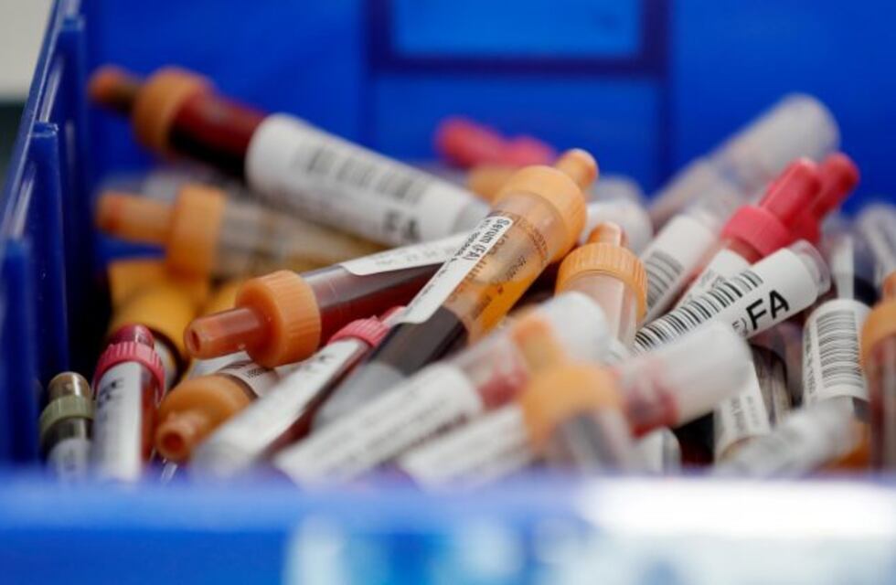 Coronavirus en Argentina: la Anmat aprobó nuevos test serológicos, usados para investigación