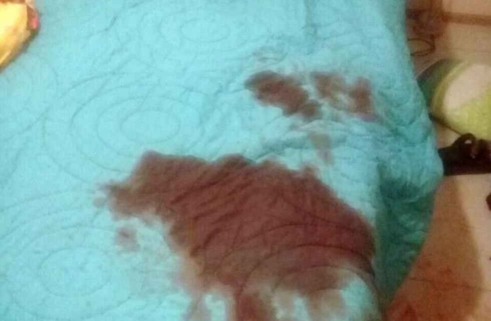 Una joven de 26 años le cortó el pene con una tijera de podar a su amante de 40