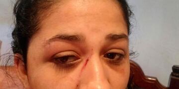 Así quedó la joven herida\u002E