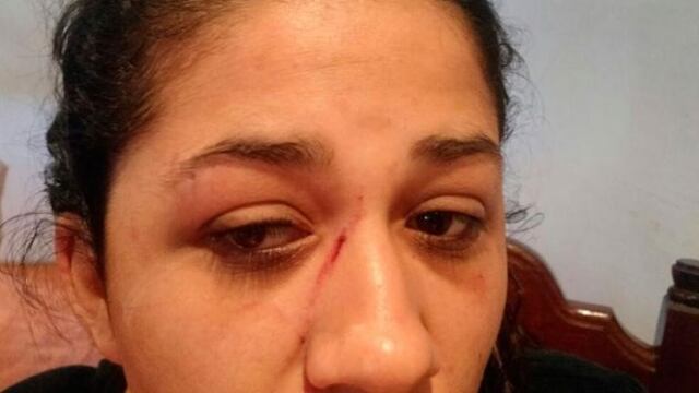 Así quedó la joven herida\u002E