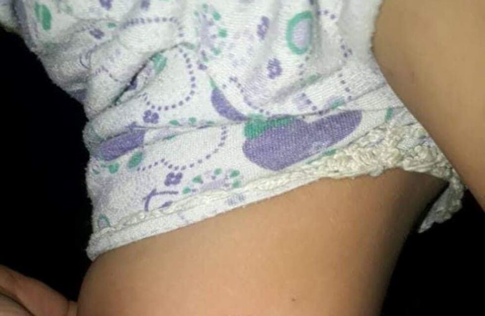 Quedó pegada a un poste del alumbrado público por una descarga eléctrica y se salvó