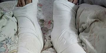 La víctima necesita ser operada y no podrá trabajar por un tiempo\u002E