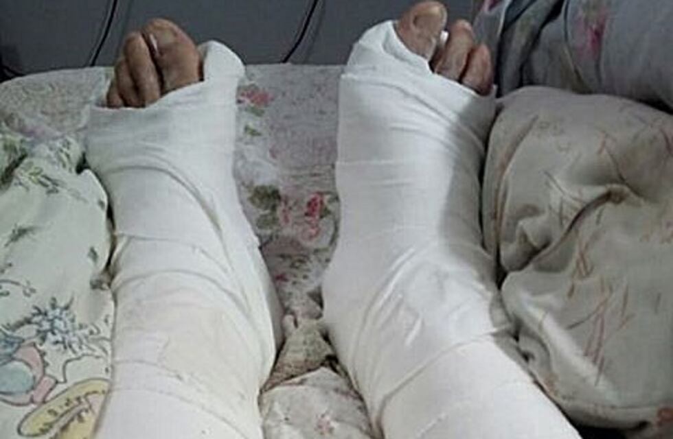 Sufrió un accidente donde se rompió las dos piernas y denunció abandono de persona