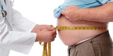 Obesidad