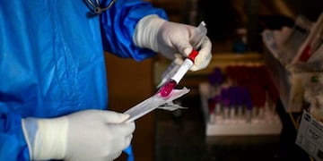 Doctor Ricardo Carrera (R) prepares a swab sample to be tested for COVID-19 at the Doctor Alberto Antranik Eurnekian Public Hospital in Ezeiza, in the outskirts of Buenos Aires on July 1, 2020\u002E (Photo by RONALDO SCHEMIDT / AFP)  CASOS DEL DIA CORONAVIRUS  PACIENTE CON COVID - 19  ARGENTINA   CASOS DEL DIA CORONAVIRUS  PACIENTE CON COVID - 19  ARGENTINA    INFECTADO INFECTADA INFECTADOS   MUESTRA DE HISOPADO