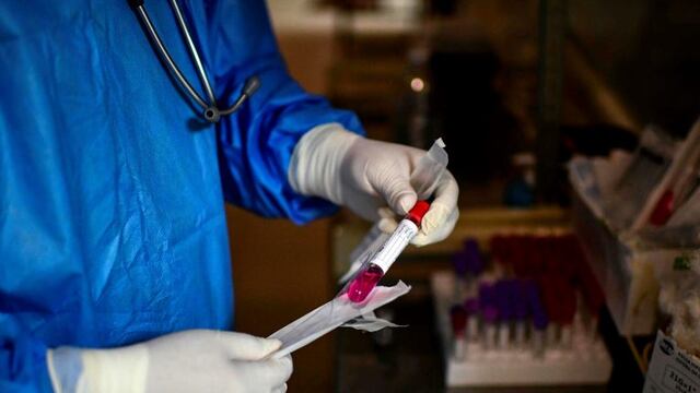 Un doctor una muestra de hisopo para la prueba de COVID-19 en el Hospital Público Doctor Alberto Antranik Eurnekian de Ezeiza. (Foto de RONALDO SCHEMIDT / AFP)