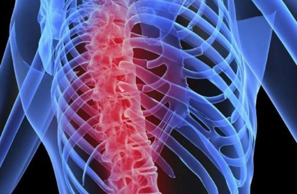 Inédito: realizaron el primer trasplante del mundo de vértebras humanas