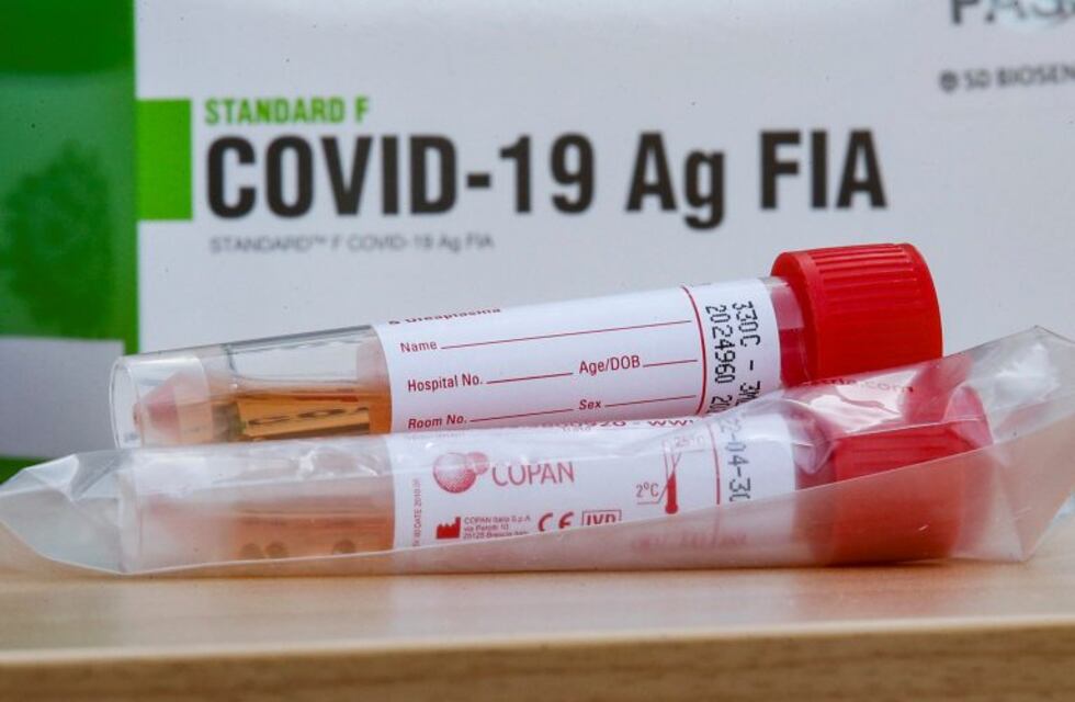 Coronavirus en Jujuy: las cifras del viernes, un esperanzador alivio