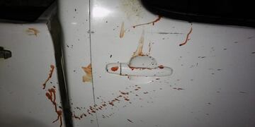 Hirieron a dos polícias en la madrugada\u002E (Web)\u002E