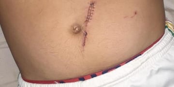 Hieren de un botellazo a dos árbitros en una final de fútbol en Montecarlo