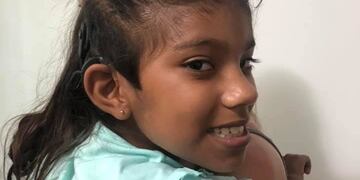 Micaela, Federal\u002E Implante Coclear