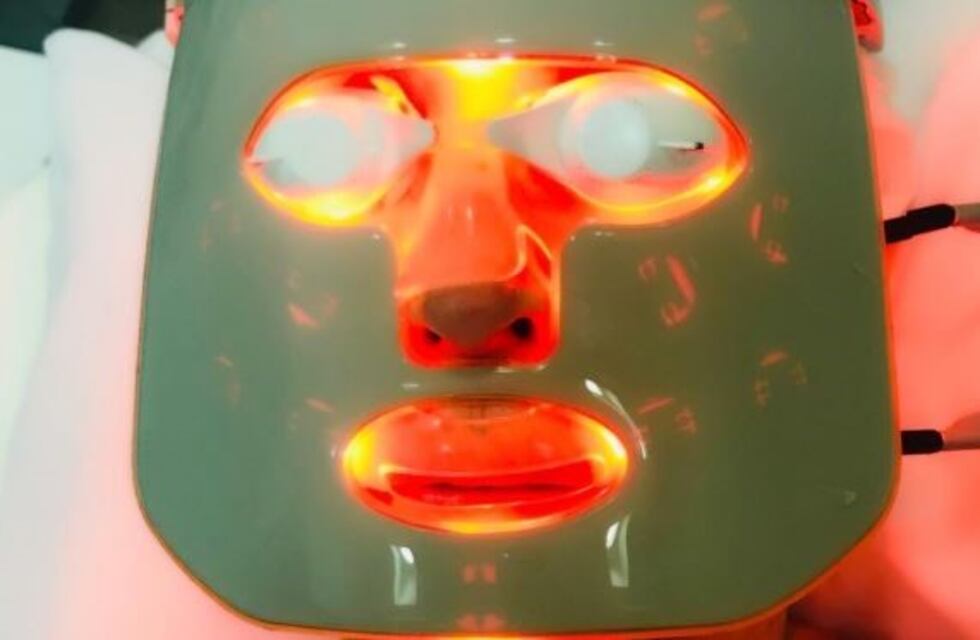 Moria Casán compartió una foto de su extraño tratamiento de belleza