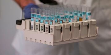 A scientist works at the serology laboratory of the San Carlos Clinic Hospital in Madrid on June 16, 2020\u002E - Spain has suffered one of the world's most deadly outbreaks of the novel coronavirus that has claimed more than 27,000 lives, although authorities say it is now well under control\u002E (Photo by PIERRE-PHILIPPE MARCOU / AFP)