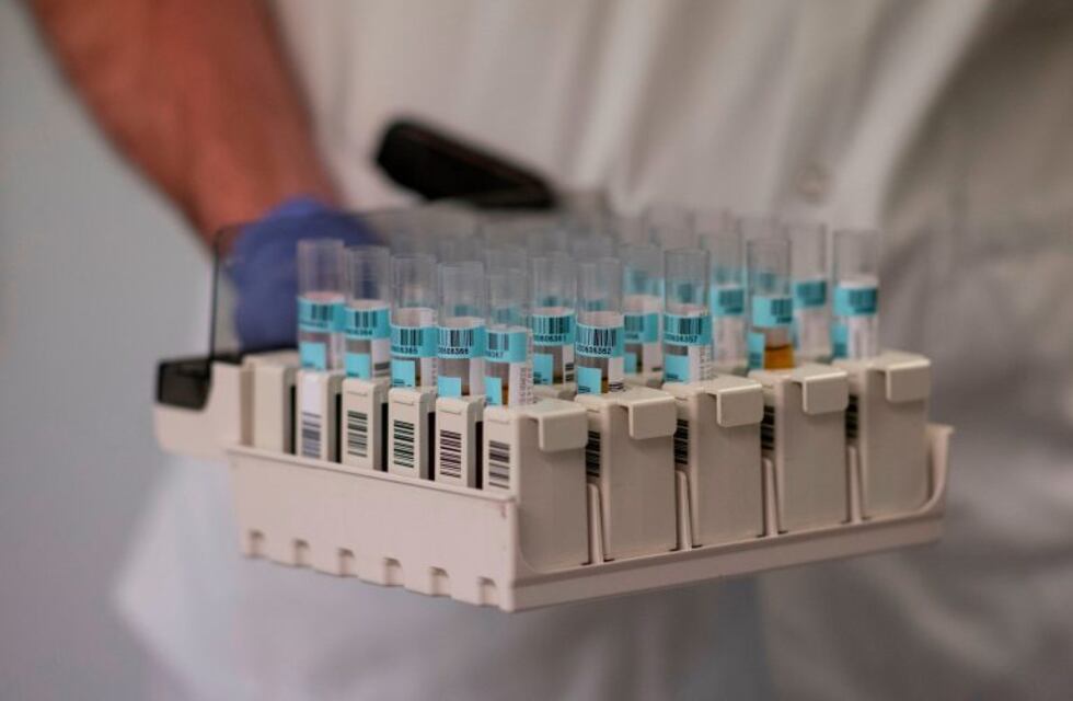 El laboratorio central enviara nuevos resultados