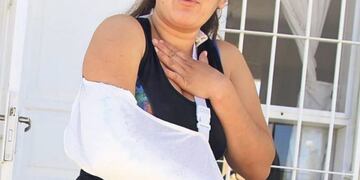 Le quiebran un brazo para robarle\u002E
