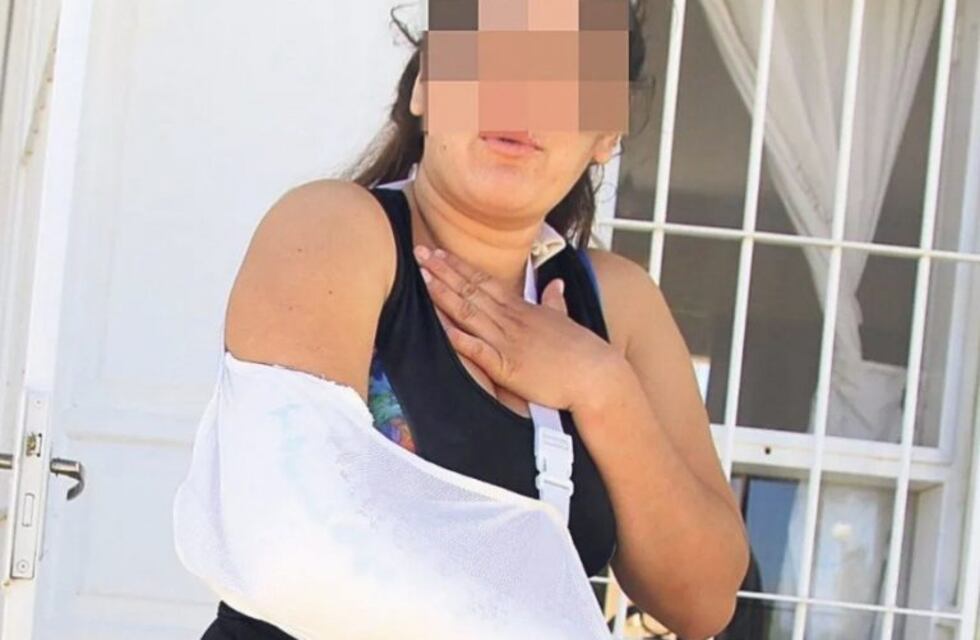 Motochorro le arrebató el celular y le fracturó un brazo