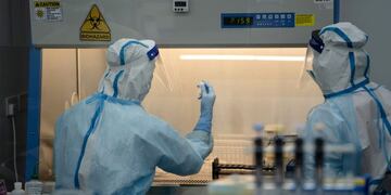 A lab technician wearing a protective suit holds up a saliva sample for RT-PCR Covid-19 testing at Prenetics Ltd\u002E's laboratory in Hong Kong, China on Friday, July 31, 2020\u002E Prenetics, along with other Hong Kong labs and hospitals, has been overloaded with people seeking virus tests since the new wave emerged 18 days ago, Chief Executive Officer Danny Yeung said in an interview last month\u002E Photographer: Roy Liu/Bloomberg