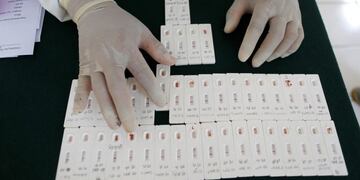 A health worker organizes coronavirus antibody test results at an office in Bali, Indonesia on Friday, Sept\u002E 11, 2020\u002E (AP Photo/Firdia Lisnawati)