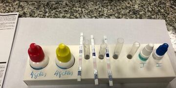 Streptococcus pyogene: los elementos necesarios para realizar el test