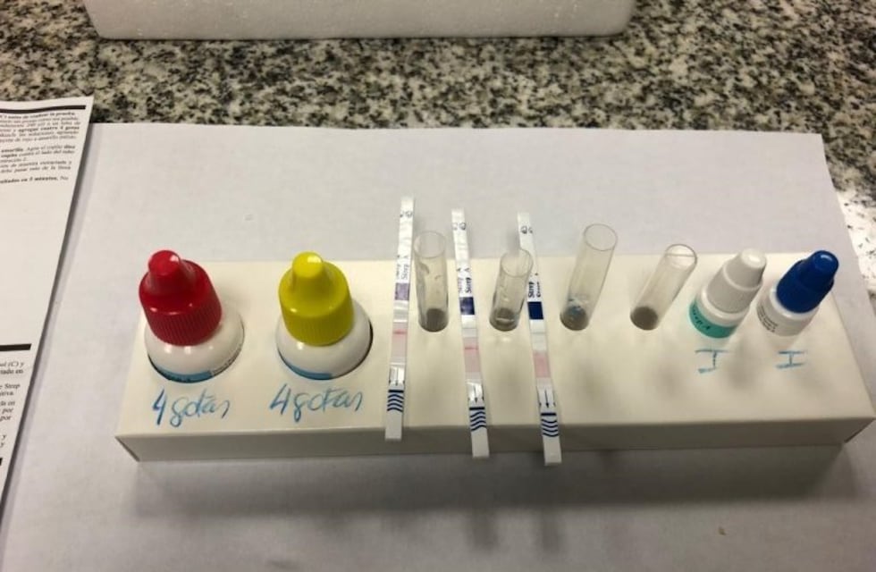 Así se realiza el test para detectar al Streptococcus pyongenes