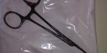 5 años después, le extraen una tijera quirúrgica que se habían "olvidado" en su interior