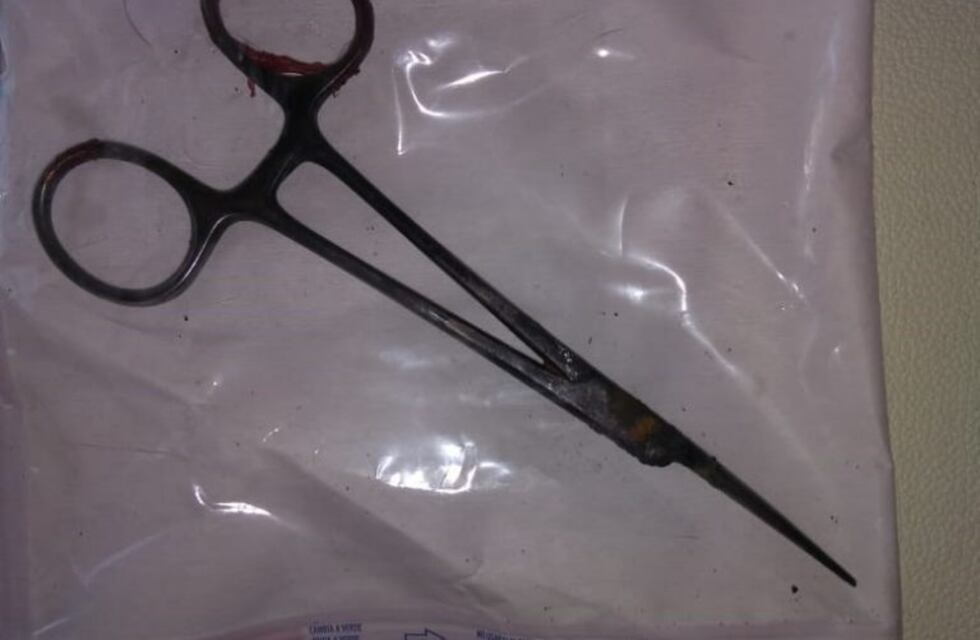 5 años después, le extraen una tijera quirúrgica que se habían "olvidado" en su interior