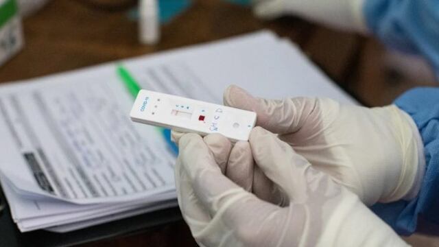 Test rápidos de coronavirus.